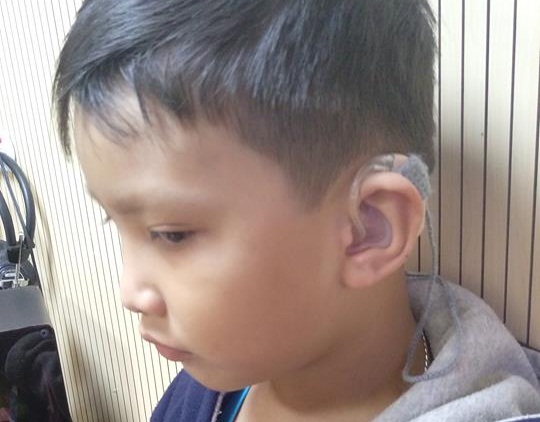 Báo cáo tặng máy trợ thính tháng 12/2017